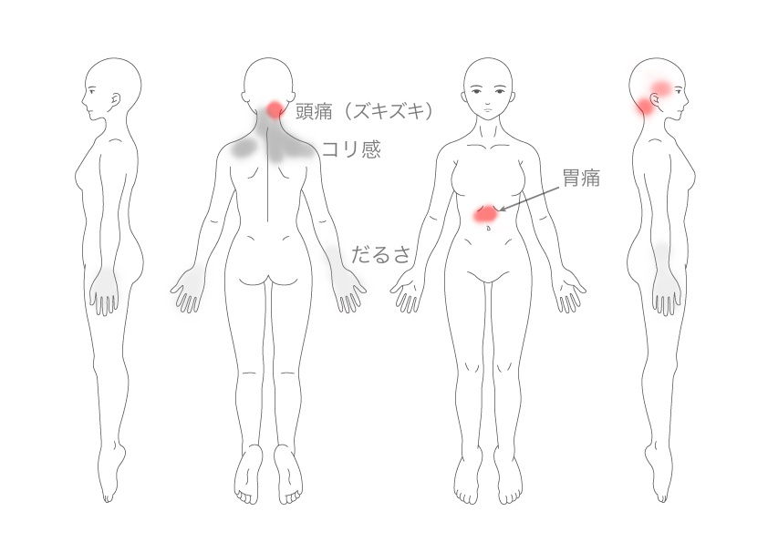 症状説明イラスト