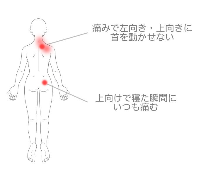 症状説明イラスト