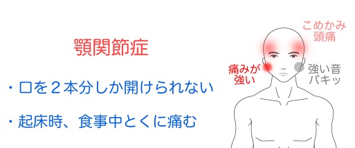 顎関節症の症例 大阪府吹田市の鍼灸院 はりきゅうroom タスケ