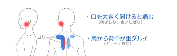 症例説明イラスト