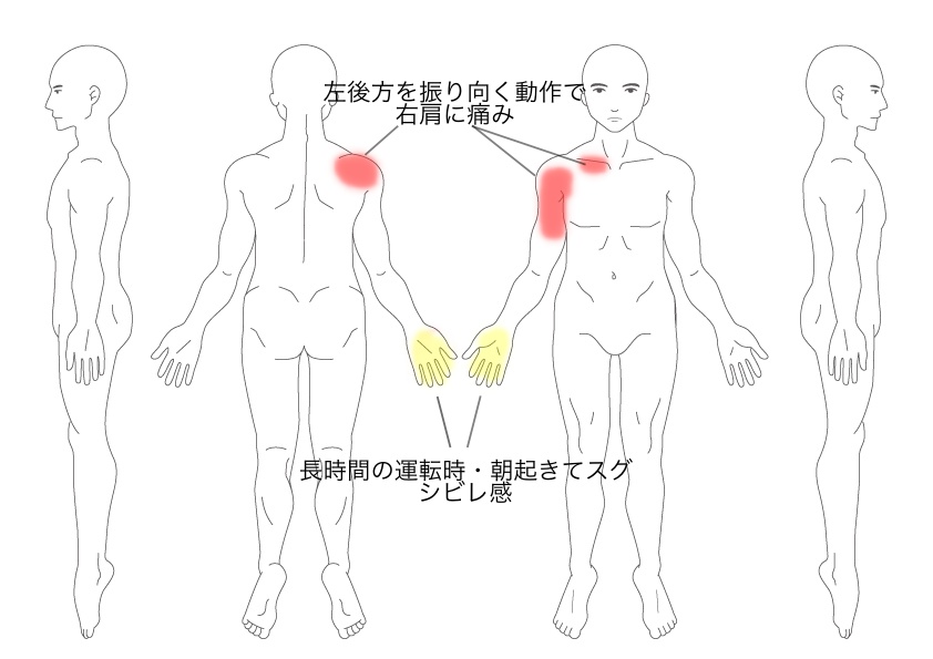 症状説明イラスト