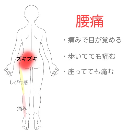 症状説明イラスト