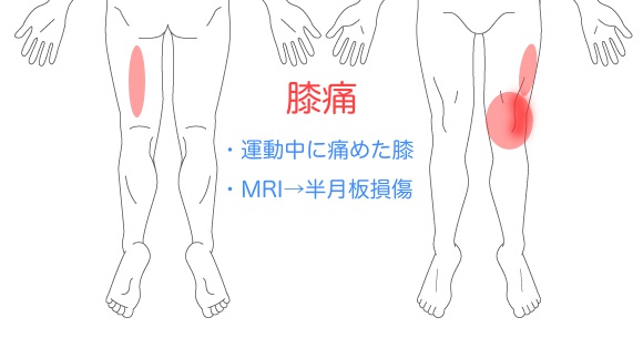 症状説明イラスト