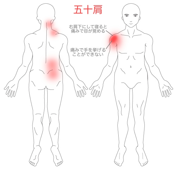 症状説明イラスト