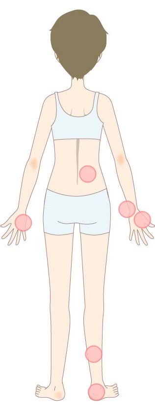 【突発性難聴・耳鳴り】ツボのイメージ（後面）