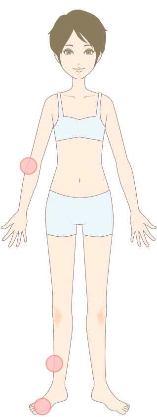 【突発性難聴・耳鳴り】ツボのイメージ（前面）