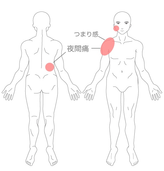 症状の説明イラスト