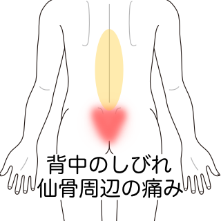 瓦を持ち上げて発症した 仙骨周辺の痛み 大阪府吹田市の鍼灸院 はりきゅうroom タスケ