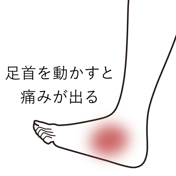 階段を踏み外して足を捻挫 固定しているが良くならない 大阪府吹田市の鍼灸院 はりきゅうroom タスケ